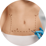 Post-surgery treatment